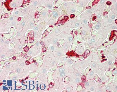 ALDH3A1 Antibody - Human Liver: Formalin-Fixed, Paraffin-Embedded (FFPE)