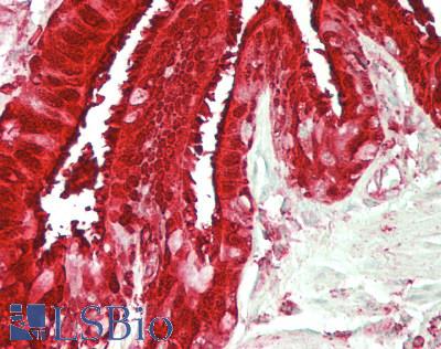 ALDH3A1 Antibody - Human Lung, Respiratory Epithelium: Formalin-Fixed, Paraffin-Embedded (FFPE)