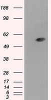 ALDH3A1 Antibody - HEK293T cells were transfected with the pCMV6-ENTRY control (Left lane) or pCMV6-ENTRY ALDH3A1 (Right lane) cDNA for 48 hrs and lysed. Equivalent amounts of cell lysates (5 ug per lane) were separated by SDS-PAGE and immunoblotted with anti-ALDH3A1.