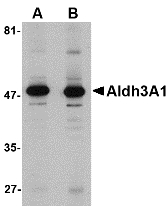 ALDH3A1 Antibody - Western blot of Aldh3A1 in human stomach lysate with Aldh3A1 antibody at (A) 1 and (B) 2 ug/ml.