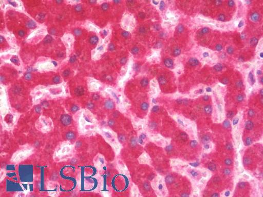 ALDH3A2 Antibody - Anti-ALDH3A2 antibody IHC staining of human liver. Immunohistochemistry of formalin-fixed, paraffin-embedded tissue after heat-induced antigen retrieval. Antibody concentration 5 ug/ml.
