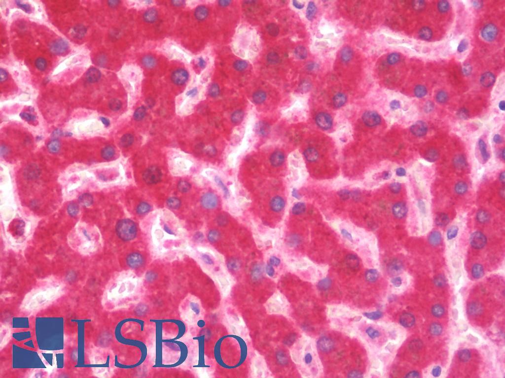 ALDH3A2 Antibody - Anti-ALDH3A2 antibody IHC staining of human liver. Immunohistochemistry of formalin-fixed, paraffin-embedded tissue after heat-induced antigen retrieval. Antibody concentration 5 ug/ml.