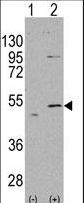 ALDH5A1 Antibody - Western blot of ALDH5A1 (arrow) using rabbit polyclonal ALDH5A1 Antibody. 293 cell lysates (2 ug/lane) either nontransfected (Lane 1) or transiently transfected with the ALDH5A1 gene (Lane 2) (Origene Technologies).