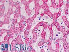 ALDH5A1 Antibody - Human Liver: Formalin-Fixed, Paraffin-Embedded (FFPE)