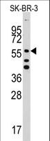 ALDH5A1 Antibody - Western blot of ALDH5A1 Antibody in SK-BR-3 cell line lysates (35 ug/lane). ALDH5A1(arrow) was detected using the purified antibody.