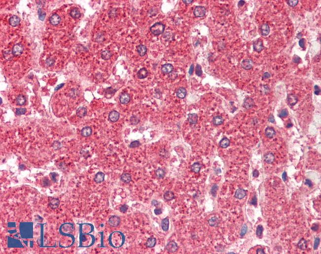 ALDH5A1 Antibody - Anti-ALDH5A1 antibody IHC staining of human liver. Immunohistochemistry of formalin-fixed, paraffin-embedded tissue after heat-induced antigen retrieval. Antibody concentration 5 ug/ml.