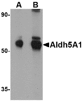 ALDH5A1 Antibody - Western blot of Aldh5A1 in mouse liver lysate with Aldh5A1 antibody at (A) 1 and (B) 2 ug/ml.
