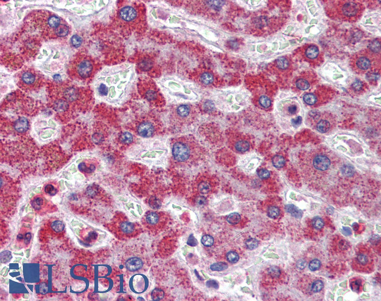 ALDH5A1 Antibody - Anti-ALDH5A1 antibody IHC of human liver. Immunohistochemistry of formalin-fixed, paraffin-embedded tissue after heat-induced antigen retrieval. Antibody concentration 5 ug/ml.