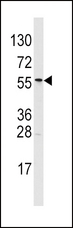 ALDH6A1 Antibody - Western blot of ALDH6A1 Antibody in T47D cell line lysates (35 ug/lane). ALDH6A1 (arrow) was detected using the purified antibody.