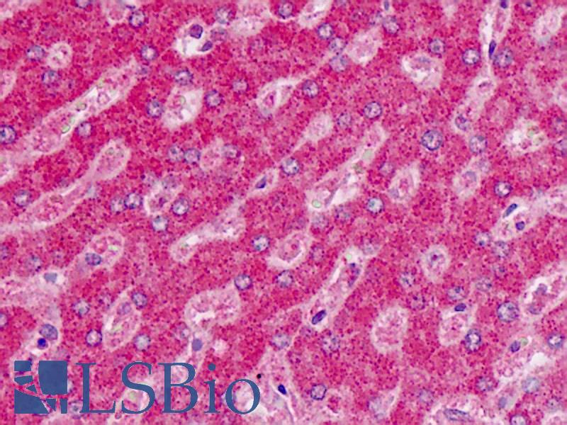 ALDH6A1 Antibody - Human Liver: Formalin-Fixed, Paraffin-Embedded (FFPE)