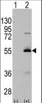 ALDH6A1 Antibody - Western blot of ALDH6A1 (arrow) using rabbit polyclonal ALDH6A1 Antibody (RB11957). 293 cell lysates (2 ug/lane) either nontransfected (Lane 1) or transiently transfected with the ALDH6A1 gene (Lane 2) (Origene Technologies).