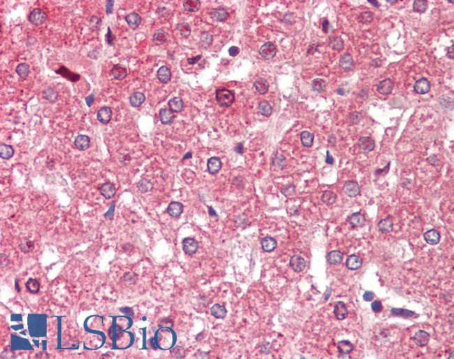 ALDH6A1 Antibody - Anti-ALDH6A1 antibody IHC staining of human liver. Immunohistochemistry of formalin-fixed, paraffin-embedded tissue after heat-induced antigen retrieval. Antibody concentration 5 ug/ml.