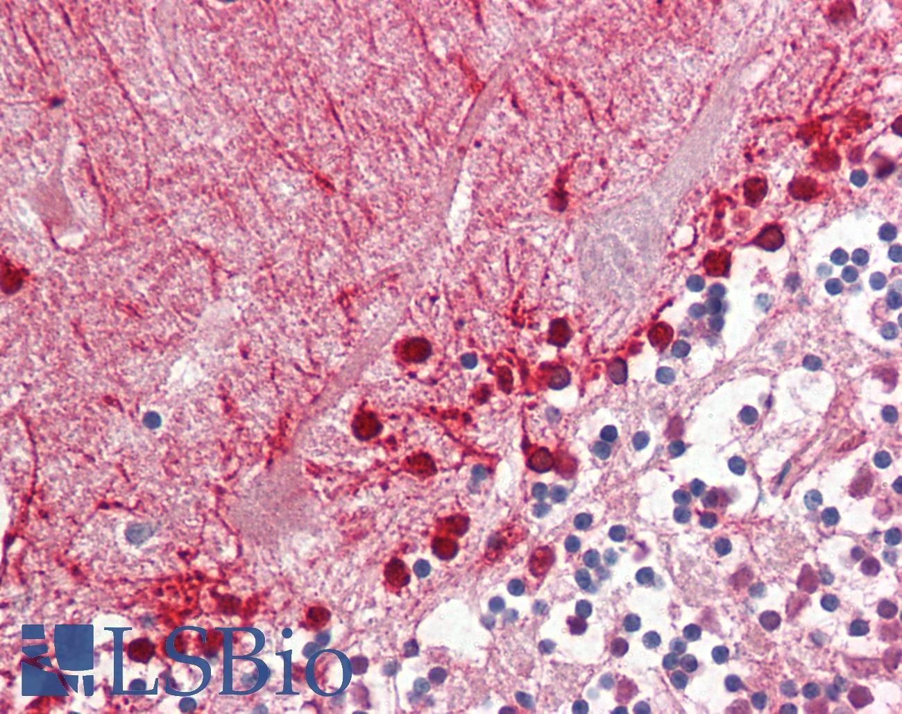 ALDH9A1 Antibody - Anti-ALDH9A1 antibody IHC staining of human brain, cerebellum. Immunohistochemistry of formalin-fixed, paraffin-embedded tissue after heat-induced antigen retrieval.