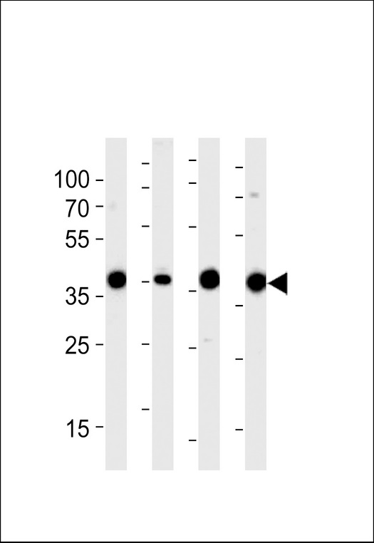 ALDOA / Aldolase A Antibody - Western blot of lysates from 293,RD,mouse NIH/3T3,rat L6 cell line (from left to right),using ALDOA Antibody. Antibody was diluted at 1:1000 at each lane. A goat anti-rabbit IgG H&L (HRP) at 1:5000 dilution was used as the secondary antibody.Lysates at 35ug per lane.