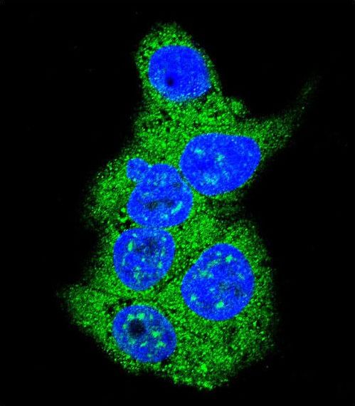 ALDOA / Aldolase A Antibody - Confocal immunofluorescence of Aldolase (ALDOA) Antibody with HepG2 cell followed by Alexa Fluor 488-conjugated goat anti-rabbit lgG (green). DAPI was used to stain the cell nuclear (blue).