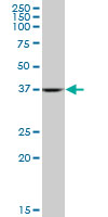 ALDOA / Aldolase A Antibody - ALDOA monoclonal antibody, clone 2E6. Western blot of ALDOA expression in HepG2.
