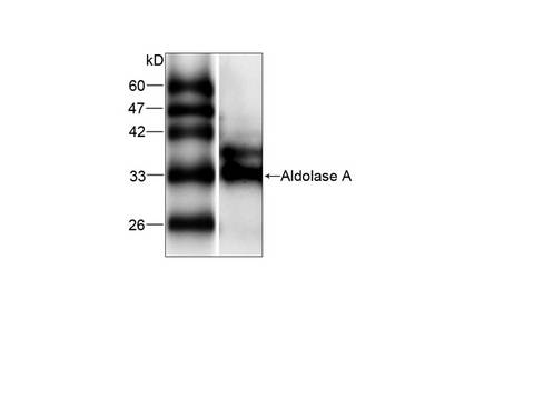 ALDOA / Aldolase A Antibody