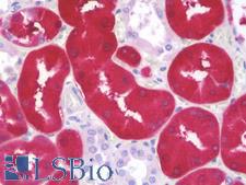 ALDOB Antibody - Anti-ALDOB antibody IHC staining of human kidney. Immunohistochemistry of formalin-fixed, paraffin-embedded tissue after heat-induced antigen retrieval. Antibody dilution 1:100.