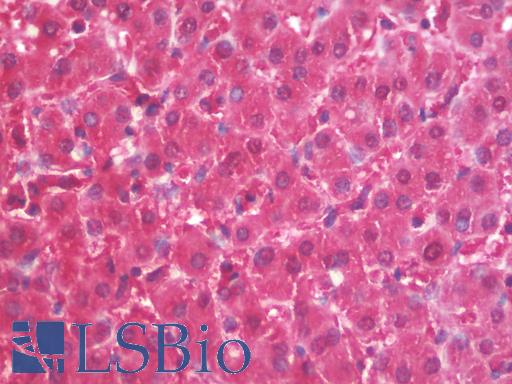 ALDOB Antibody - Anti-ALDOB antibody IHC staining of human liver. Immunohistochemistry of formalin-fixed, paraffin-embedded tissue after heat-induced antigen retrieval.