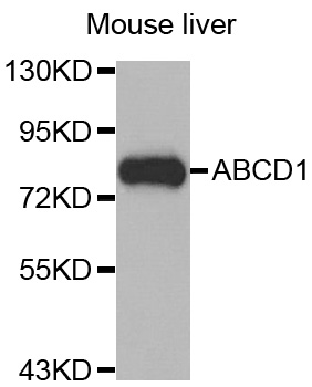 ALDP / ABCD1 Antibody - Western blot analysis of extracts of Mouse liver cell line, using ABCD1 antibody.