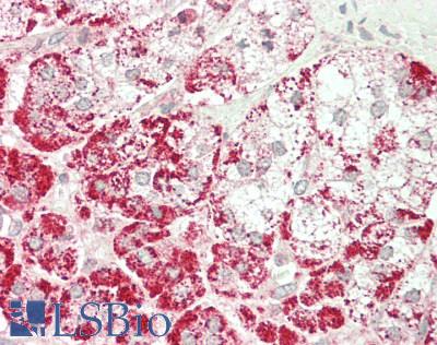 ALDP / ABCD1 Antibody - Human Adrenal: Formalin-Fixed, Paraffin-Embedded (FFPE)