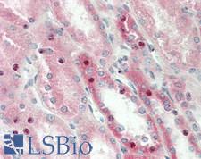 ALK-6 / BMPR1B Antibody - Human Kidney: Formalin-Fixed, Paraffin-Embedded (FFPE)