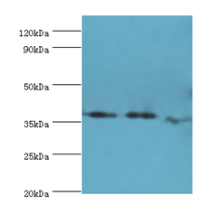 ALK2 / ACVR1 Antibody - Western blot. All lanes: ACVR1 antibody at 6 ug/ml. Lane 1: A549 whole cell lysate. Lane 2: HepG2 whole cell lysate. Lane 3: mouse gonad tissue. Secondary antibody: Goat polyclonal to rabbit at 1:10000 dilution. Predicted band size: 39 kDa. Observed band size: 39 kDa.