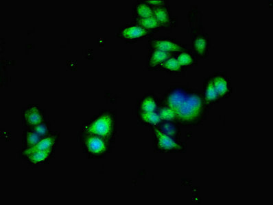 ALK2 / ACVR1 Antibody - Immunofluorescent analysis of PC-3 cells using ACVR1 Antibody at dilution of 1:100 and Alexa Fluor 488-congugated AffiniPure Goat Anti-Rabbit IgG(H+L)