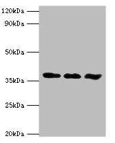 ALK2 / ACVR1 Antibody - Western blot All lanes: ACVR1 antibody at 6µg/ml Lane 1: A549 whole cell lysate Lane 2: HepG2 whole cell lysate Lane 3: Mouse gonad tissue Secondary Goat polyclonal to rabbit IgG at 1/10000 dilution Predicted band size: 39 kDa Observed band size: 39 kDa
