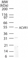 ALK2 / ACVR1 Antibody - Western blot of ACVR1 in mouse kidney lysate using antibody at 5 ug/ml