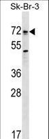 ALK3 / BMPR1A Antibody - Mouse Bmpr1a Antibody western blot of SK-BR-3 cell line lysates (35 ug/lane). The Bmpr1a antibody detected the Bmpr1a protein (arrow).