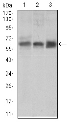 ALK3 / BMPR1A Antibody - Western blot using BMPR1A mouse monoclonal antibody against PC-3 (1), K562 (2) cell lysate, and Mouse liver (3) tissue lysate.