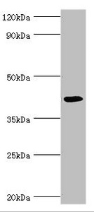 ALKBH1 / ALKB Antibody - Western blot All lanes: Alkylated DNA repair protein alkB homolog 1 antibody at 9µg/ml + Mouse kidney tissue Secondary Goat polyclonal to rabbit IgG at 1/10000 dilution Predicted band size: 44 kDa Observed band size: 44 kDa