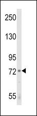 ALOX12 / 12 Lipoxygenase Antibody - Western blot of ALOX12 Antibody in K562 cell line lysates (35 ug/lane). ALOX12 (arrow) was detected using the purified antibody.