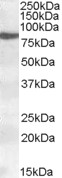ALOX15 / 15-Lipoxygenase Antibody - ALOX15 / 15-Lipoxygenase antibody (0.2µg/ml) staining of nuclear HeLa lysate (35µg protein in RIPA buffer). Detected by chemiluminescence.