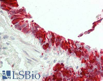 ALOX15 / 15-Lipoxygenase Antibody - Human Lung, Respiratory Epithelium: Formalin-Fixed, Paraffin-Embedded (FFPE)