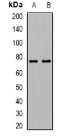 ALOX15B / 15-LOX-2 Antibody - Western blot analysis of 15-LO2 expression in HL60 (A); mouse ovary (B) whole cell lysates.