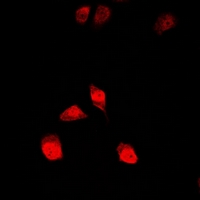ALOX15B / 15-LOX-2 Antibody - Immunofluorescent analysis of 15-LO2 staining in HeLa cells. Formalin-fixed cells were permeabilized with 0.1% Triton X-100 in TBS for 5-10 minutes and blocked with 3% BSA-PBS for 30 minutes at room temperature. Cells were probed with the primary antibody in 3% BSA-PBS and incubated overnight at 4 deg C in a humidified chamber. Cells were washed with PBST and incubated with a DyLight 594-conjugated secondary antibody (red) in PBS at room temperature in the dark.
