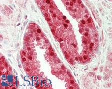 ALOX15B / 15-LOX-2 Antibody - Human Prostate: Formalin-Fixed, Paraffin-Embedded (FFPE)
