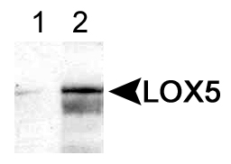 ALOX5 / 5-LOX Antibody - Detection of LOX% in human peripheral leukocytes using ALOX5 / 5-LOX Antibody at 0.5 (Lane 1) and 2.0 ug/ml (Lane 2). This image was taken for the unconjugated form of this product. Other forms have not been tested.
