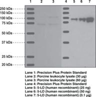 ALOX5 / 5-LOX Antibody - Western blot of ALOX5 / 5-Lipoxygenase antibody.