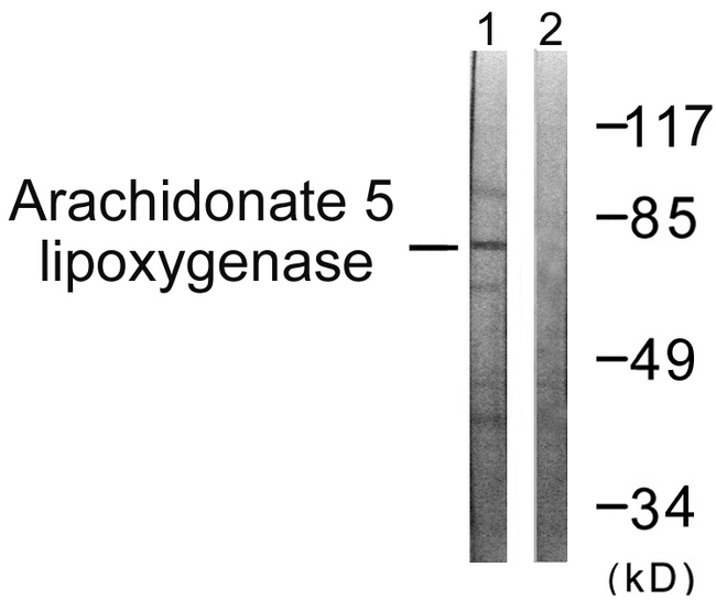 ALOX5 / 5-LOX Antibody - Western blot analysis of lysates from HUVEC cells, using Arachidonate 5 Lipoxygenase Antibody. The lane on the right is blocked with the synthesized peptide.