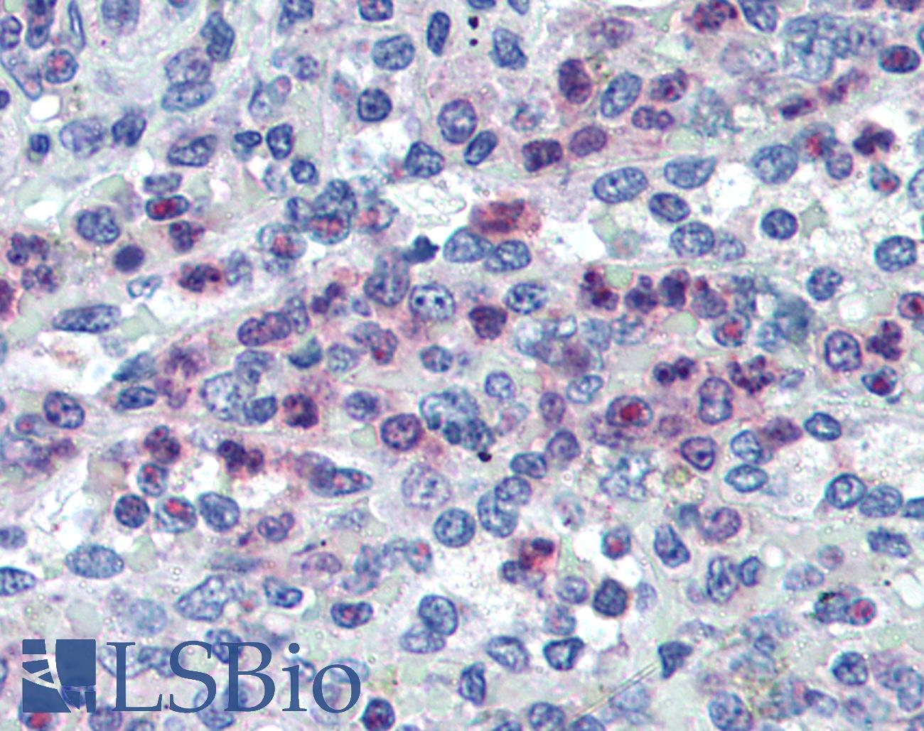 ALOX5 / 5-LOX Antibody - Anti-5 Lipoxygenase antibody IHC of human spleen, neutrophils. Immunohistochemistry of formalin-fixed, paraffin-embedded tissue after heat-induced antigen retrieval. Antibody concentration 10 ug/ml.  This image was taken for the unconjugated form of this product. Other forms have not been tested.