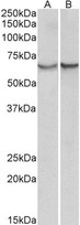 Alpha-1-Antichymotrypsin Antibody - SERPINA3 antibody (0.3 ug/ml) staining of albumin-depleted Serum (A) and Plasma(B) lysates (35 ug protein in RIPA buffer). Primary incubation was 1 hour. Detected by chemiluminescence.