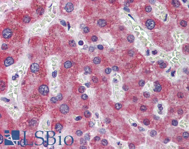 Alpha-Fetoprotein Antibody - Anti-Alpha-Fetoprotein antibody IHC of human liver. human. Immunohistochemistry of formalin-fixed, paraffin-embedded tissue after heat-induced antigen retrieval. Antibody dilution 1:200.