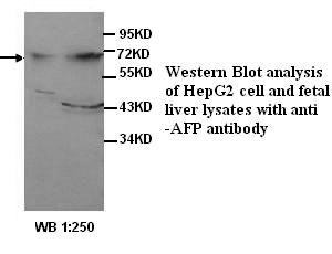 Alpha-Fetoprotein Antibody