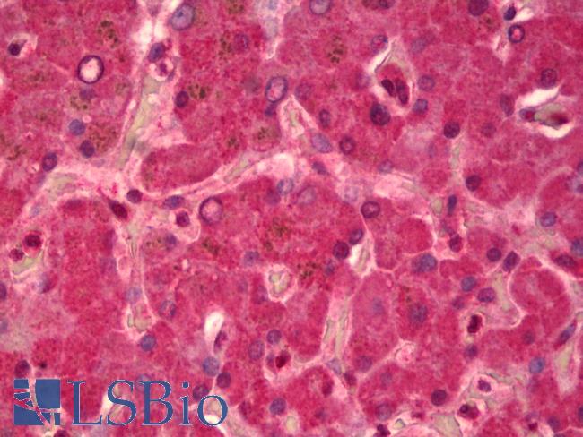 Alpha-Fetoprotein Antibody - Anti-Alpha-Fetoprotein antibody IHC of human liver. Immunohistochemistry of formalin-fixed, paraffin-embedded tissue after heat-induced antigen retrieval. Antibody concentration 2.5 ug/ml.
