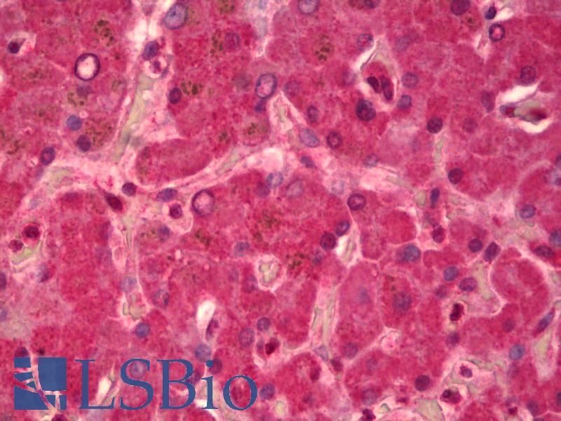 Alpha-Fetoprotein Antibody - Anti-Alpha-Fetoprotein antibody IHC of human liver. Immunohistochemistry of formalin-fixed, paraffin-embedded tissue after heat-induced antigen retrieval. Antibody concentration 2.5 ug/ml.