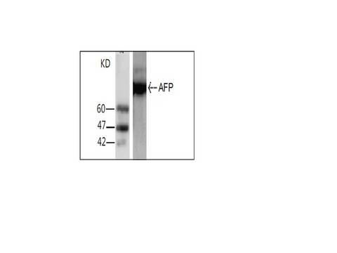Alpha-Fetoprotein Antibody