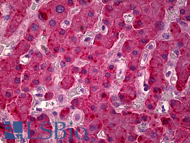 Alpha-Fetoprotein Antibody - Anti-Alpha-Fetoprotein antibody IHC of human liver. Immunohistochemistry of formalin-fixed, paraffin-embedded tissue after heat-induced antigen retrieval. Antibody concentration 20 ug/ml.